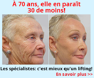 astuce beauté