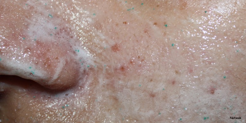 exfoliant douce visage Douce métamorphose de Lady Green