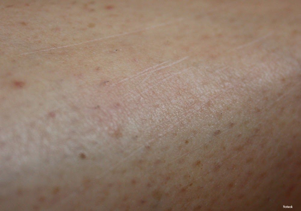 griffures Silk-épil 9 SkinSpa beauty Set Edition 9-969 