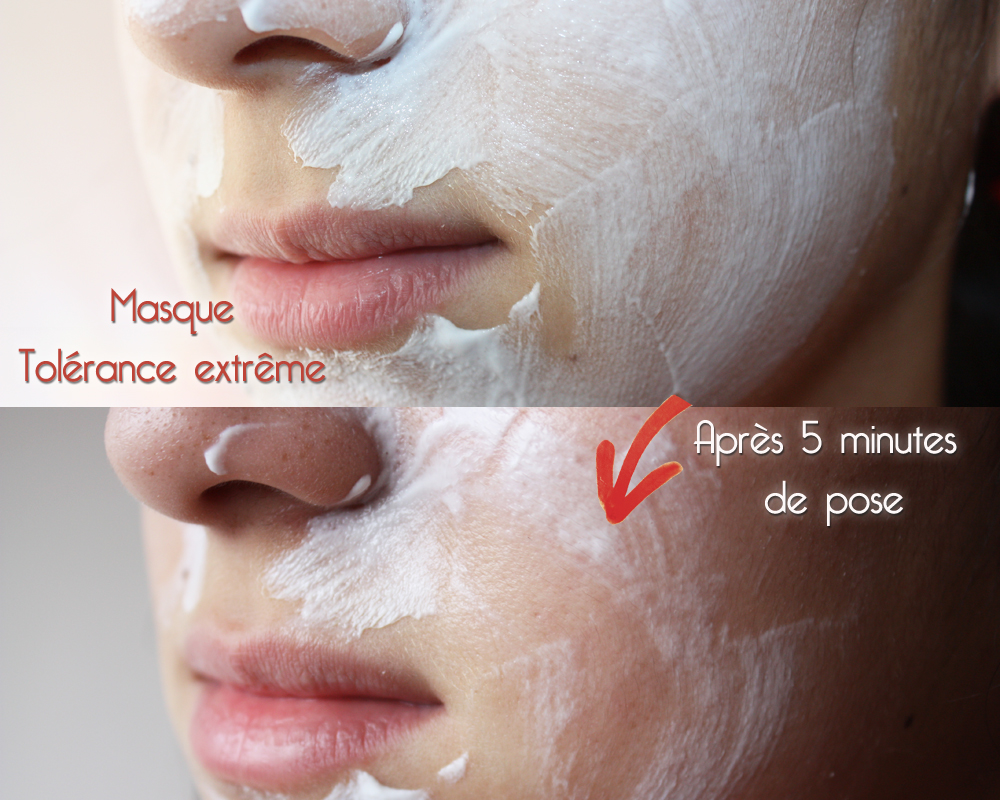 Tolérance extrême Avène