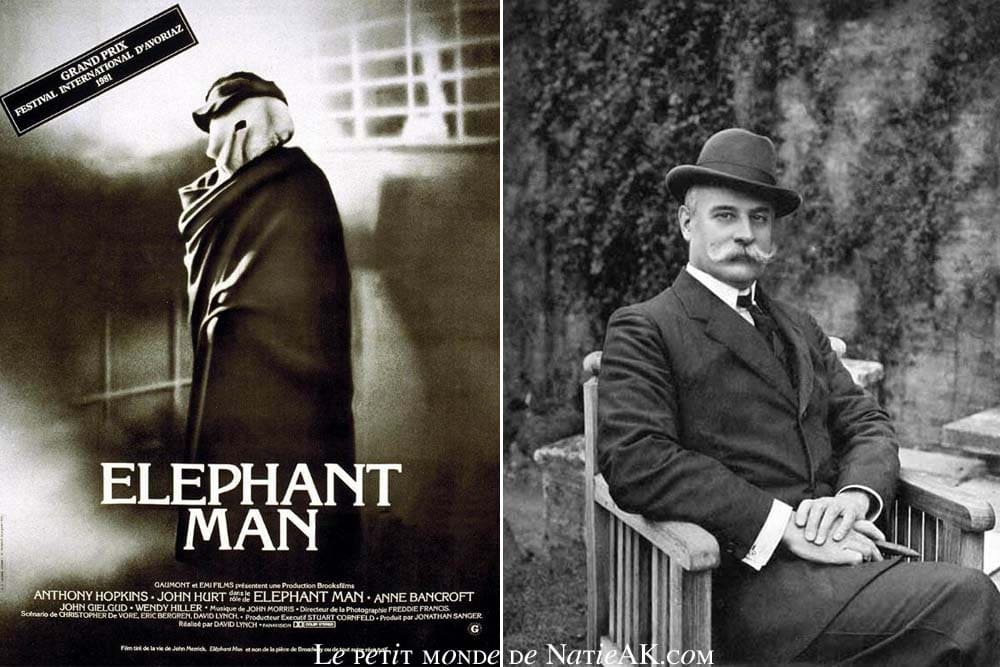 œuvres basées sur des faits réels Pourquoi le film Elephant Man est en noir et blanc ?